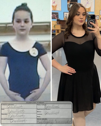 before-after